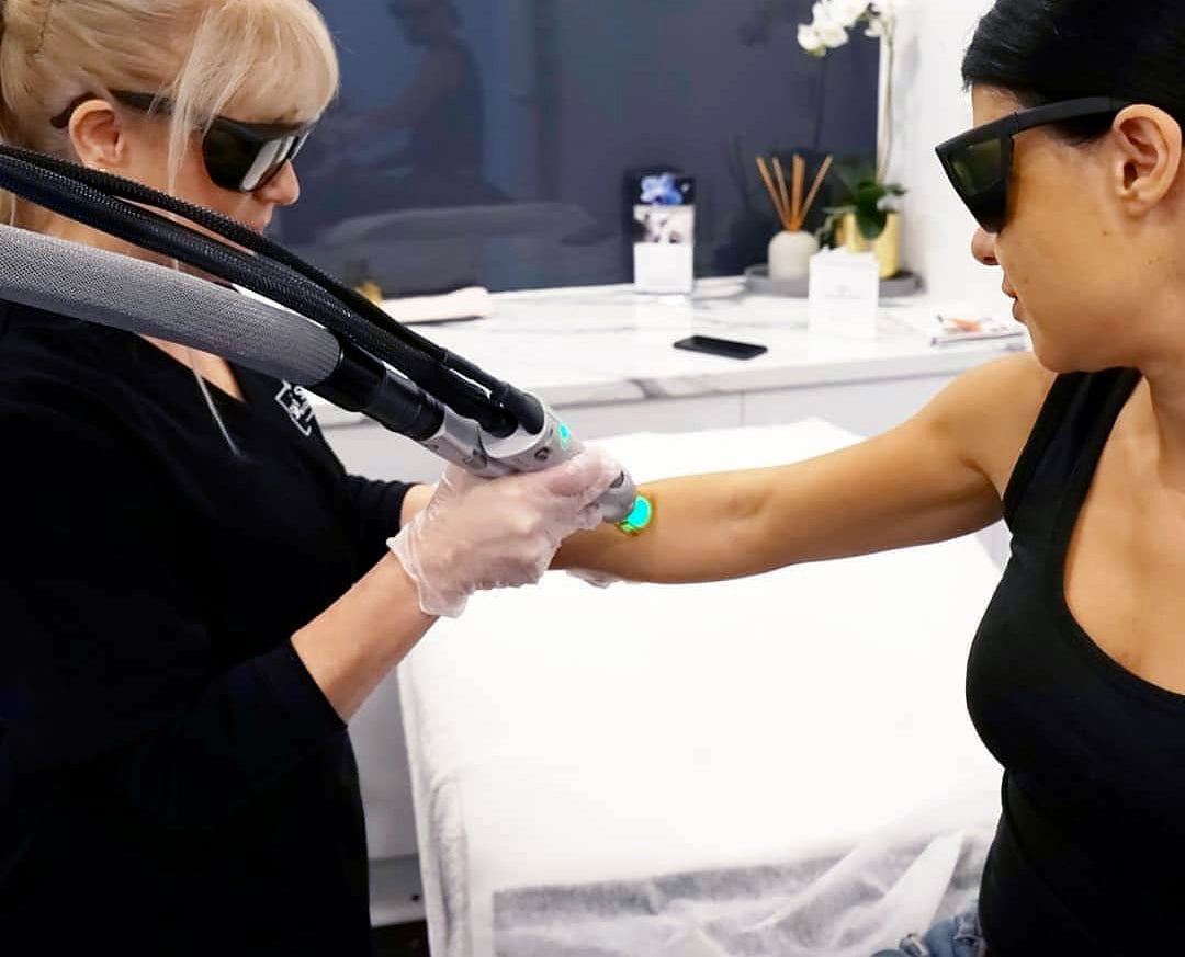 FEMALE LASER HAIR REMOVAL