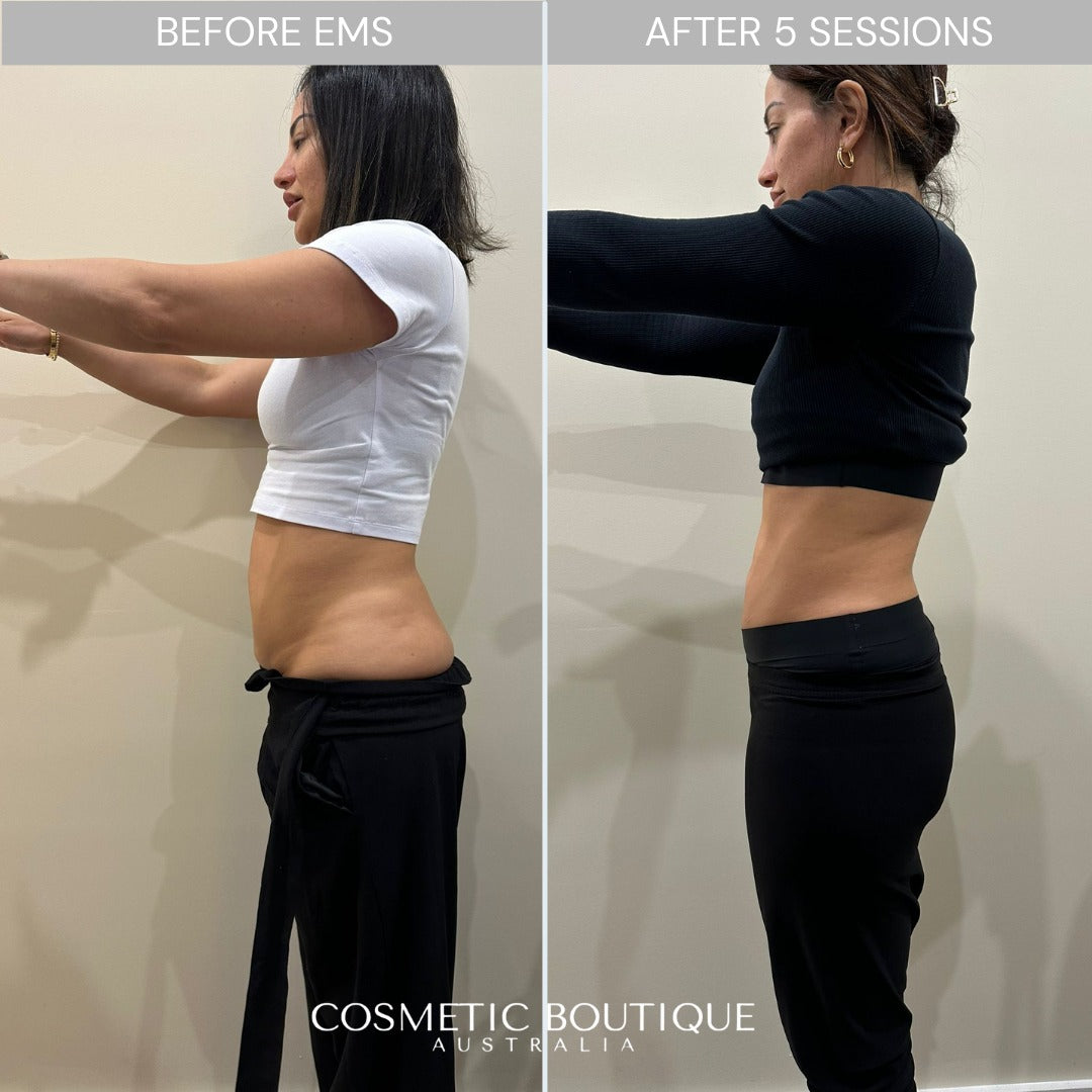 EMS BODY TONING | $49 FIRST SESSION - INTRO OFFER