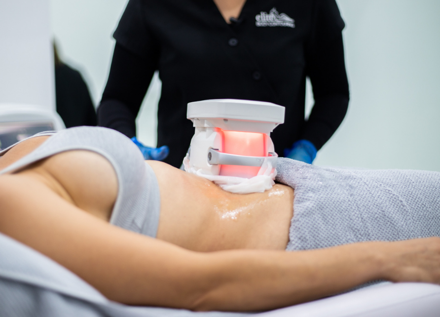 CRYO SCULPT FAT FREEZING (CRYOLIPOLISIS) - PER APPLICATOR