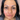 FIBROBLAST ANTI-WRINKLE - FOREHEAD
