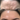 FIBROBLAST ANTI-WRINKLE - FOREHEAD