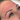 FIBROBLAST ANTI-WRINKLE - FOREHEAD