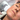 HIFU NON-SURGICAL FACE LIFT