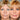 HIFU NON-SURGICAL FACE LIFT